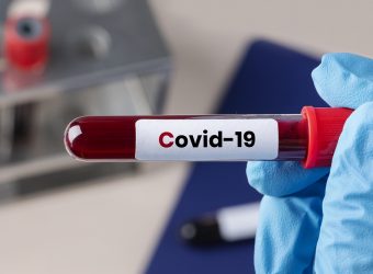 Surgeon holding a coronavirus blood test tube