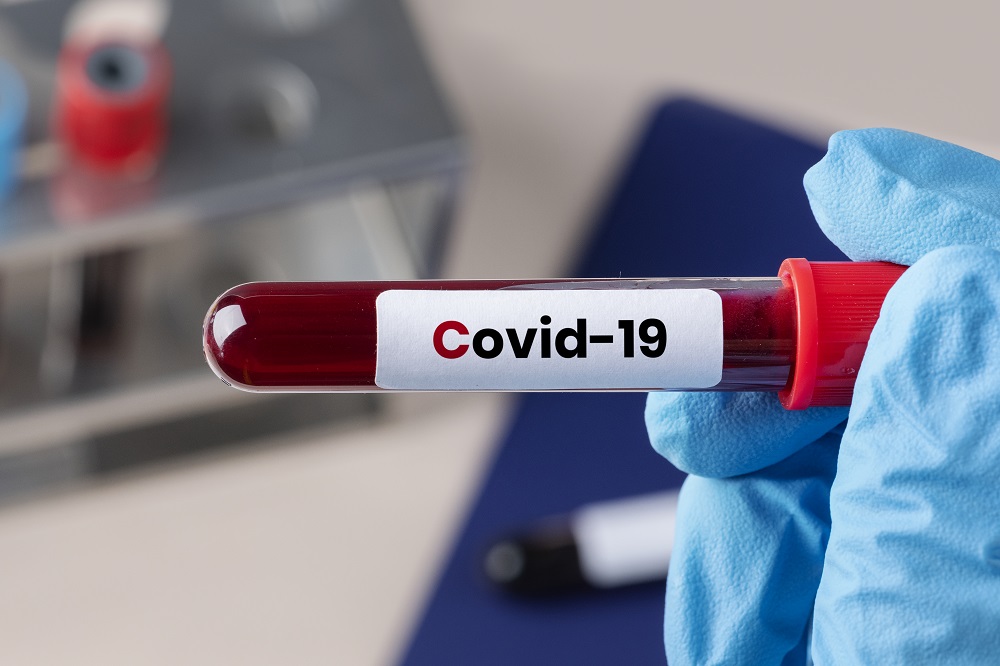 Surgeon holding a coronavirus blood test tube